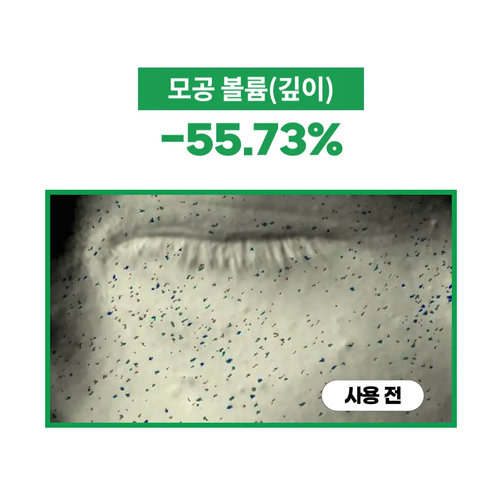 [1+1/1등 모공 수분천재크림] 에스네이처 아쿠아 스쿠알란 수분크림 60ml 더블기획 (+발렌 파우치 키링) 상세페이지 31